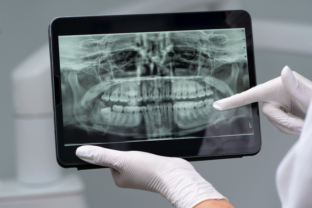 Digital X-Rays in Colorado Springs