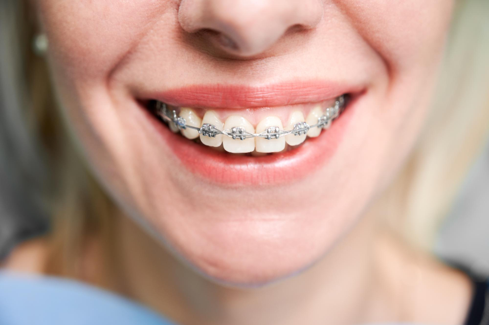 orthodontic services  Colorado Springs, CO