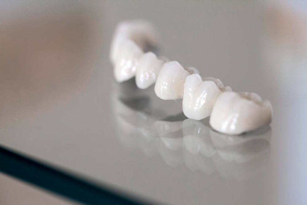 Same-day Crowns in Colorado Springs